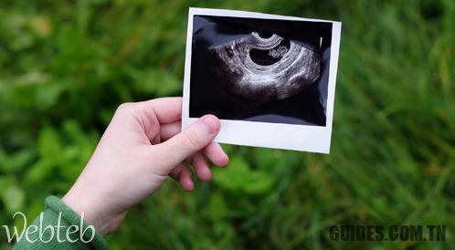 Les symptômes de la prééclampsie peuvent constituer une menace pour votre vie et celle du fœtus