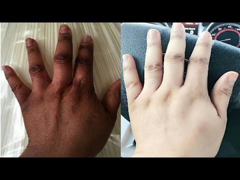 Comment faire pour éclaircir les doigts ?