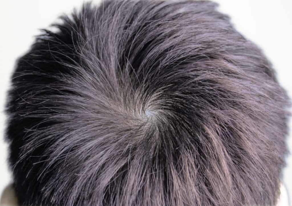 Qu’est-ce qu’un épi dans les cheveux ?